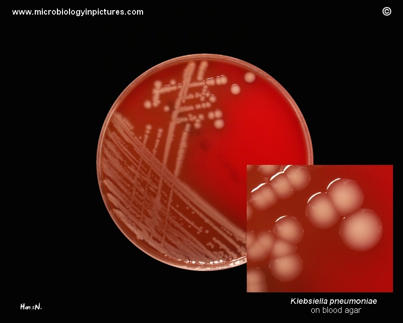 Klebsiella Pneumoniae Picture Cultivation On Blood Agar Colonies